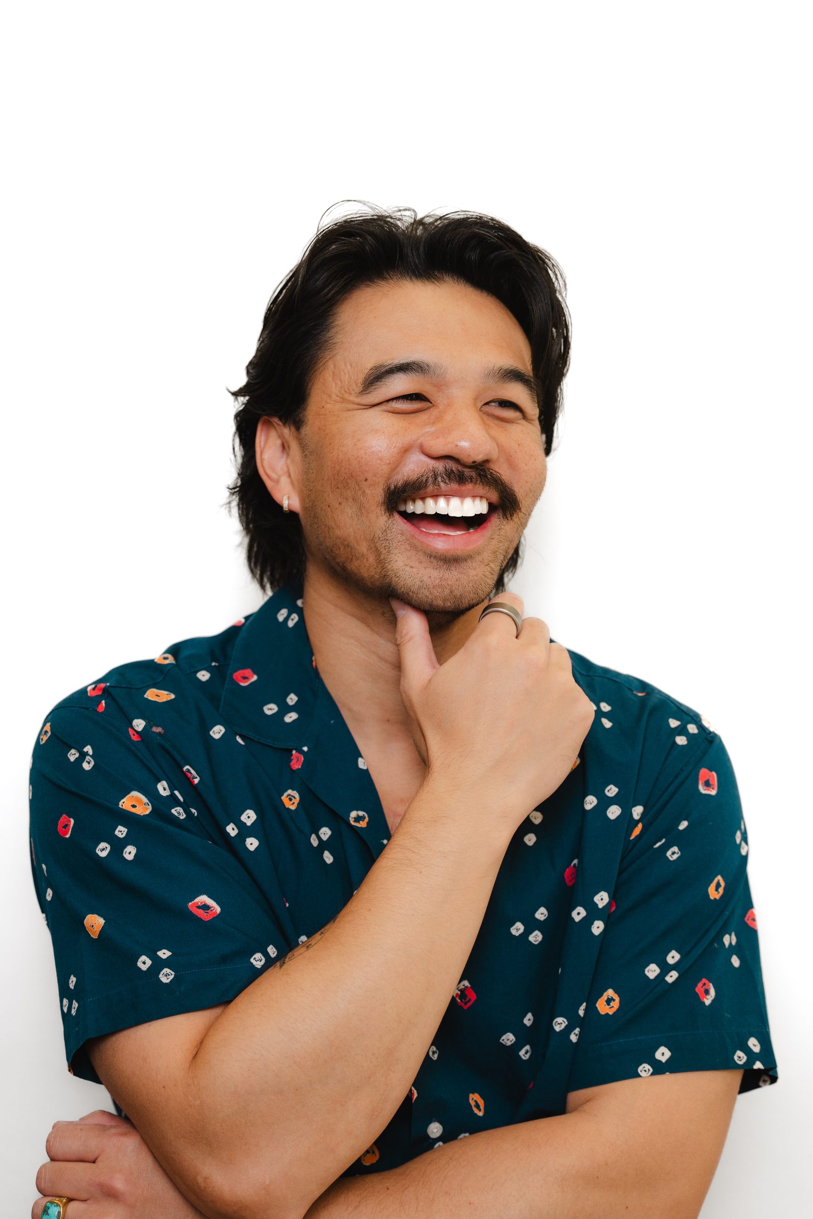 Smile Design patient at Vegas Choice Dental in Las Vegas